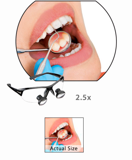 Unveränderte DFV-Herstellerillustration derselben dentalen Szene bei 2,5-facher Vergrößerung, mit Produktdarstellung und kleiner unvergrößerter Referenz.