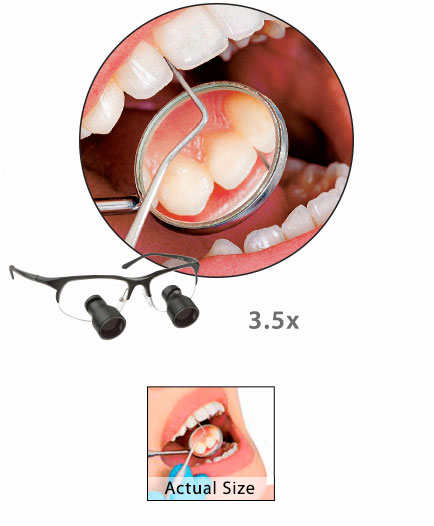 Unveränderte DFV-Herstellerillustration derselben dentalen Szene bei 3,5-facher Vergrößerung, mit Produktdarstellung und kleiner unvergrößerter Referenz.