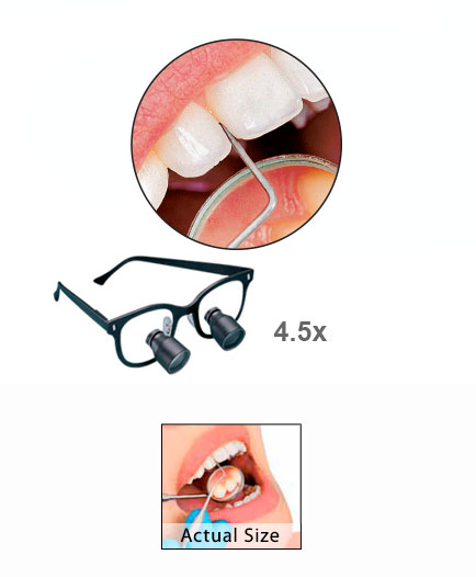Unveränderte DFV-Herstellerillustration derselben dentalen Szene bei 4,5-facher Vergrößerung, mit Produktdarstellung und kleiner unvergrößerter Referenz.